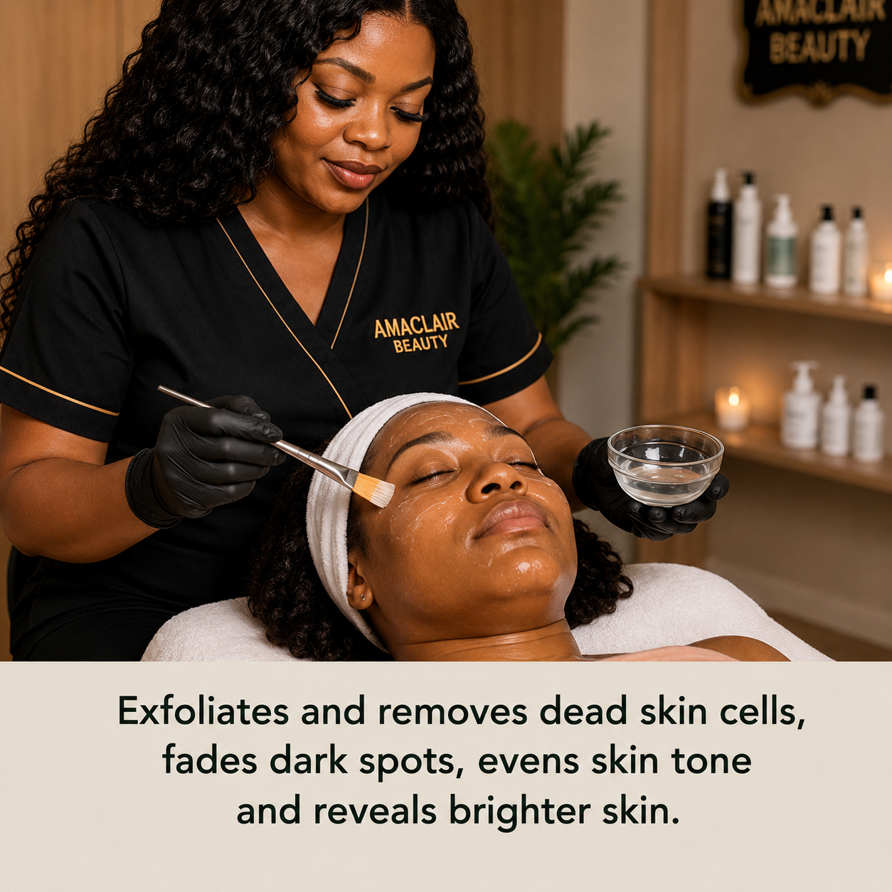 chemical peel