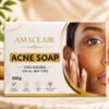 Acne Soap